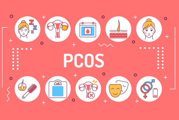 PCOS Management