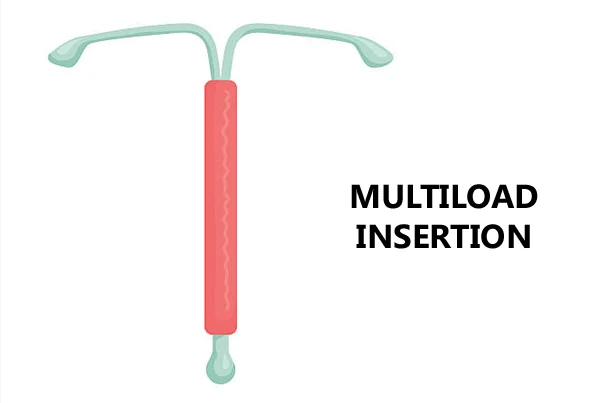 Multiload Insertion