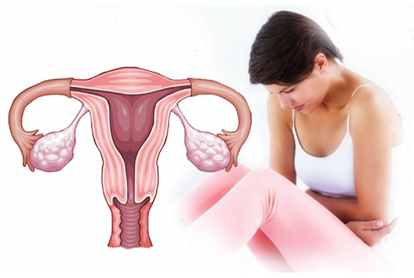 Abnormal Uterine Bleeding