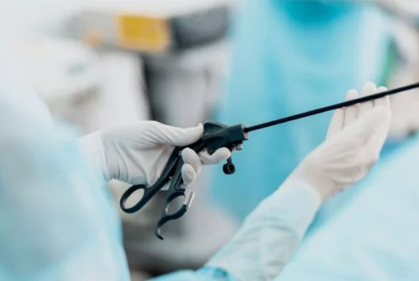 Laparoscopy Surgery