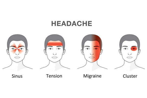 Headache